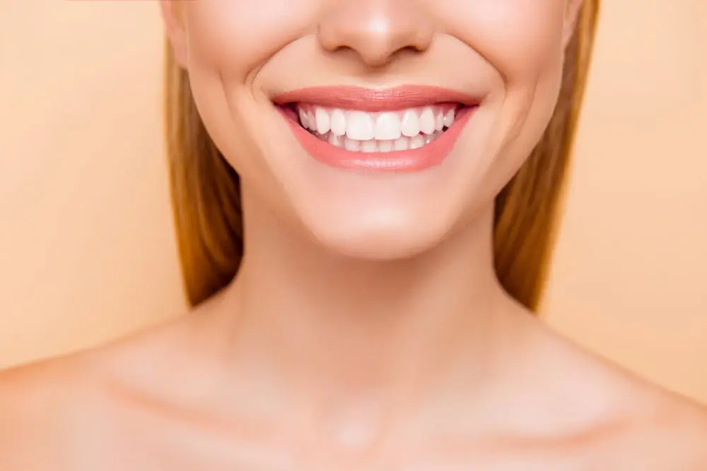 Hollywood Smile